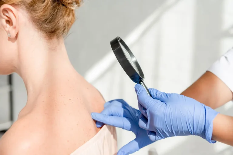 Dermatology